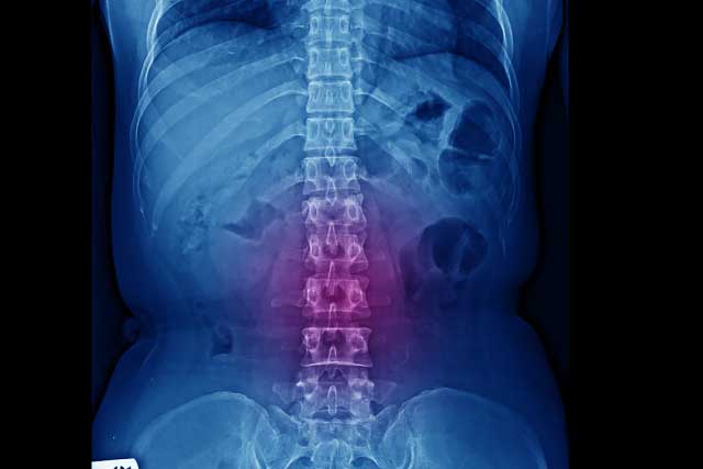 武蔵村山市 整骨院,やまかわ整骨院